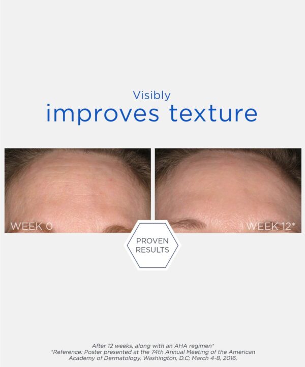 Smooth Surface Glycolic Daily Peel - Image 5
