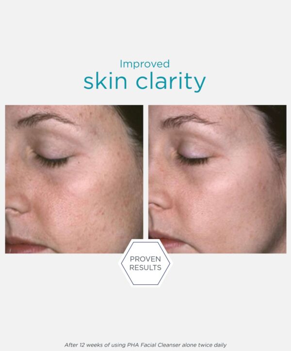 PHA Facial Cleanser - Image 6