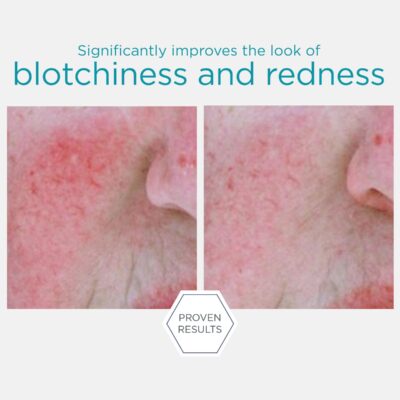 Redness Neutralising Serum