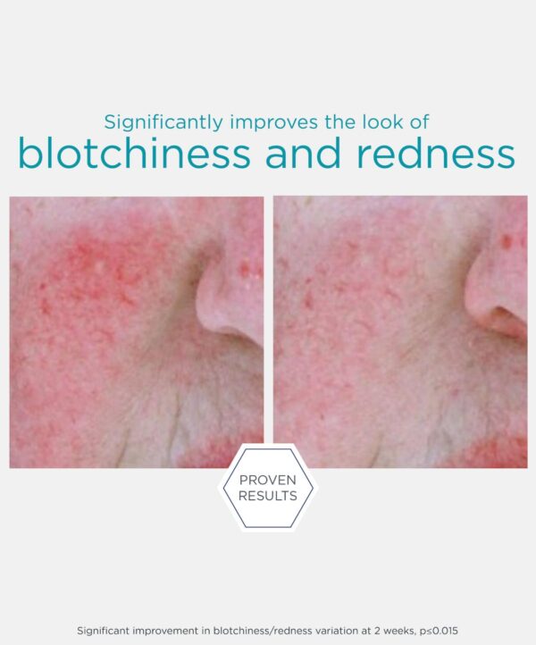 Redness Neutralising Serum