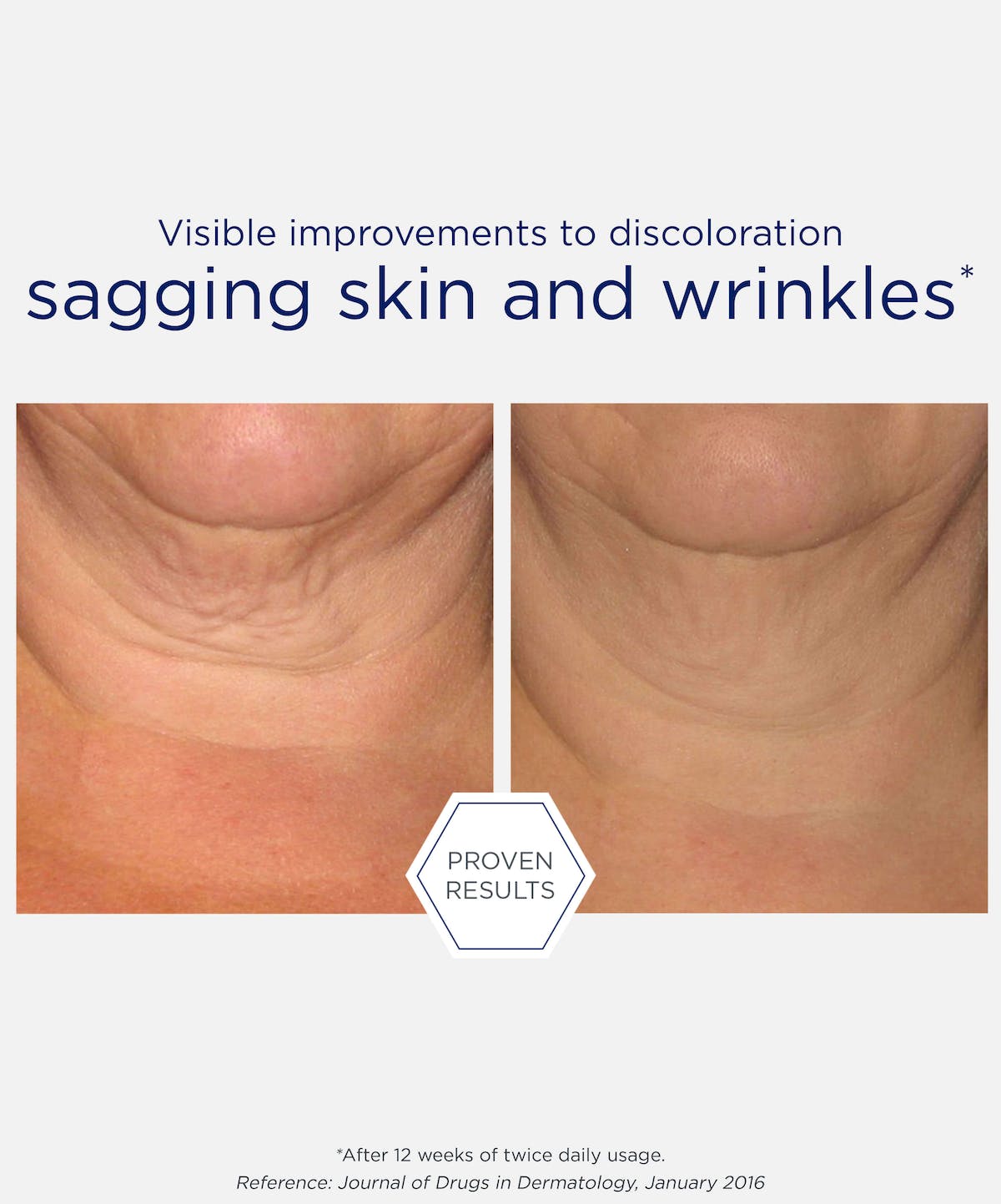 Neck sales firming cream