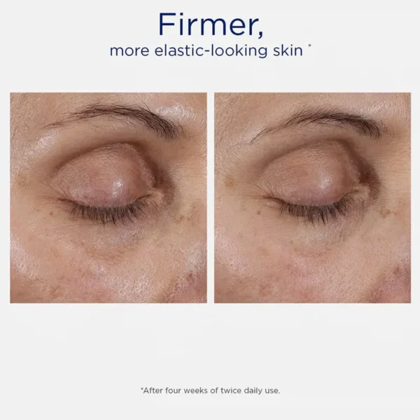 Intensive Eye Therapy - Image 5