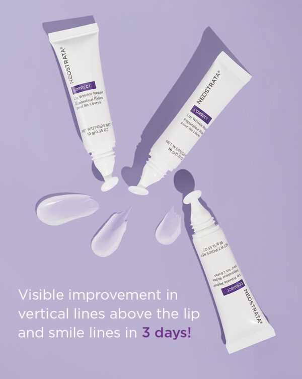 Lip Wrinkle Repair - Image 3